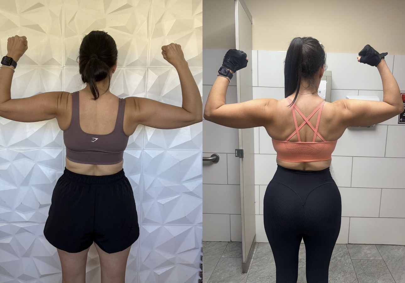 Brenda Cáceres - Antes y Después